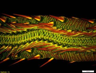 Illustration for article titled The Alien and Eerie Beauty of the Year's Best Microscopic Photos